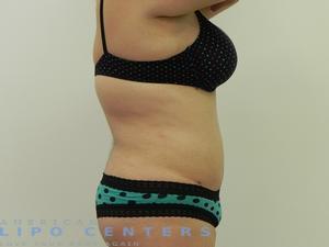 americanlipocenters_58.jpg